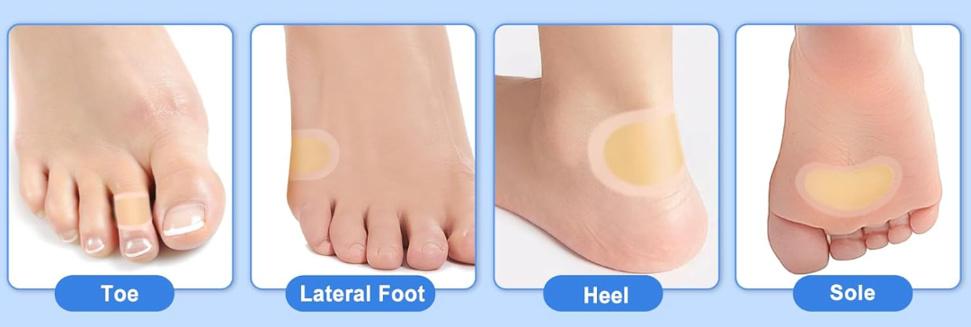 Hydrocolloid Blister Bandages — 4-Shape Variety Pack