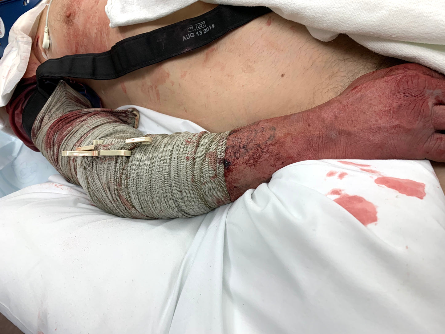 Module 1 - Hemorrhage Control — Introductory Price IFAK360