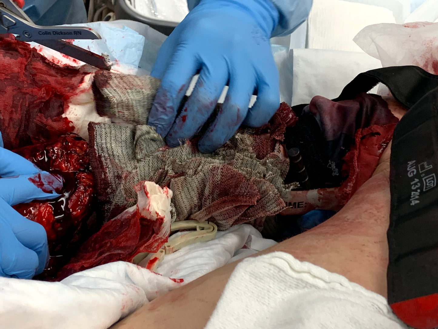Module 1 - Hemorrhage Control — Introductory Price IFAK360